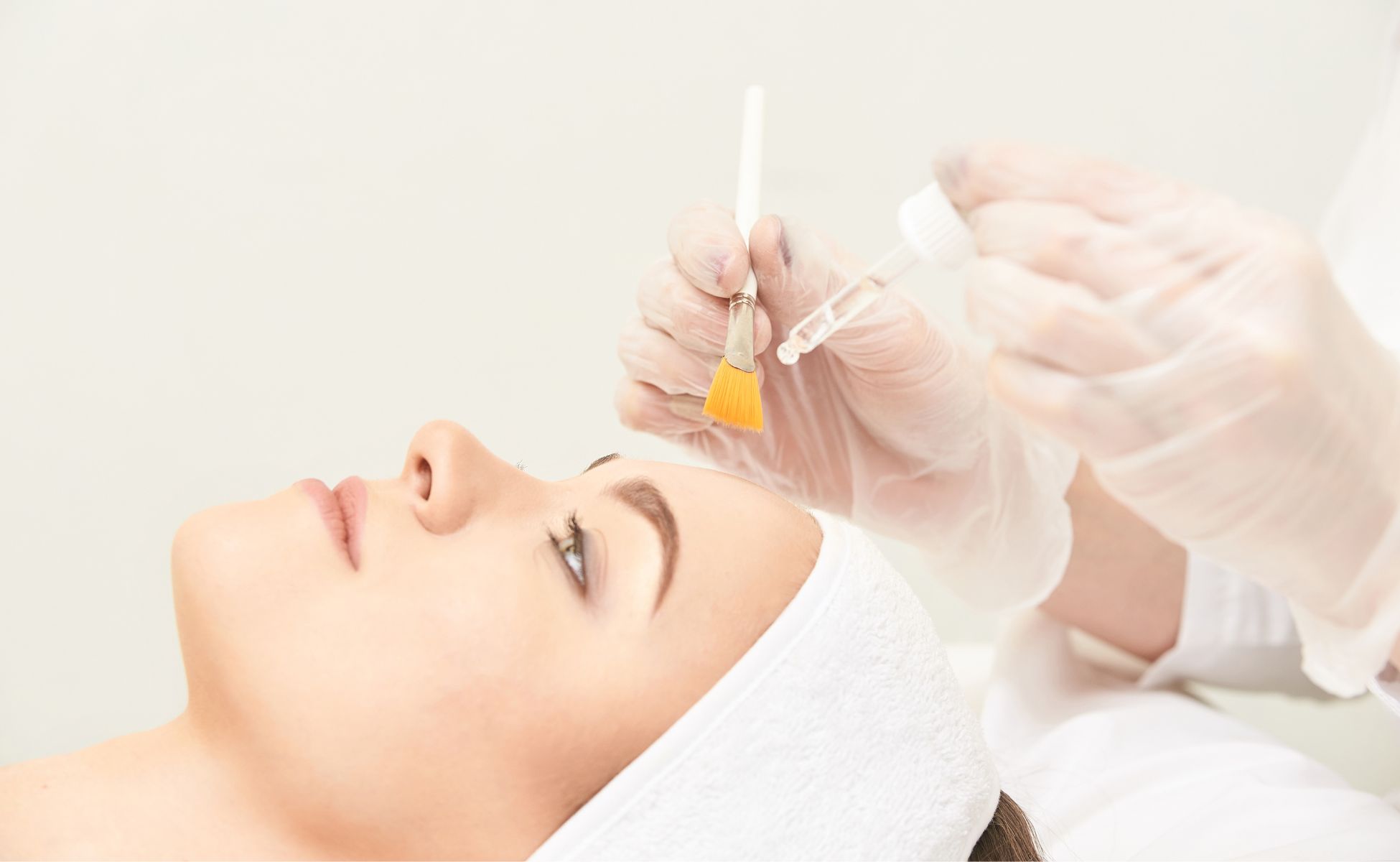 Chemical Peel