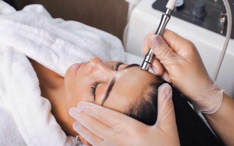 microdermabrasion