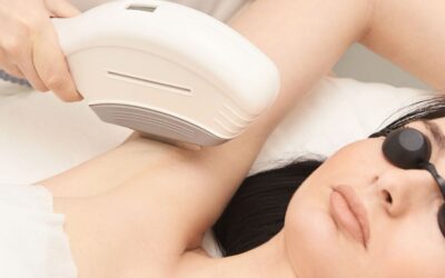 Say Goodbye to Shaving: What You Need to Know About IPL Laser Hair Removal