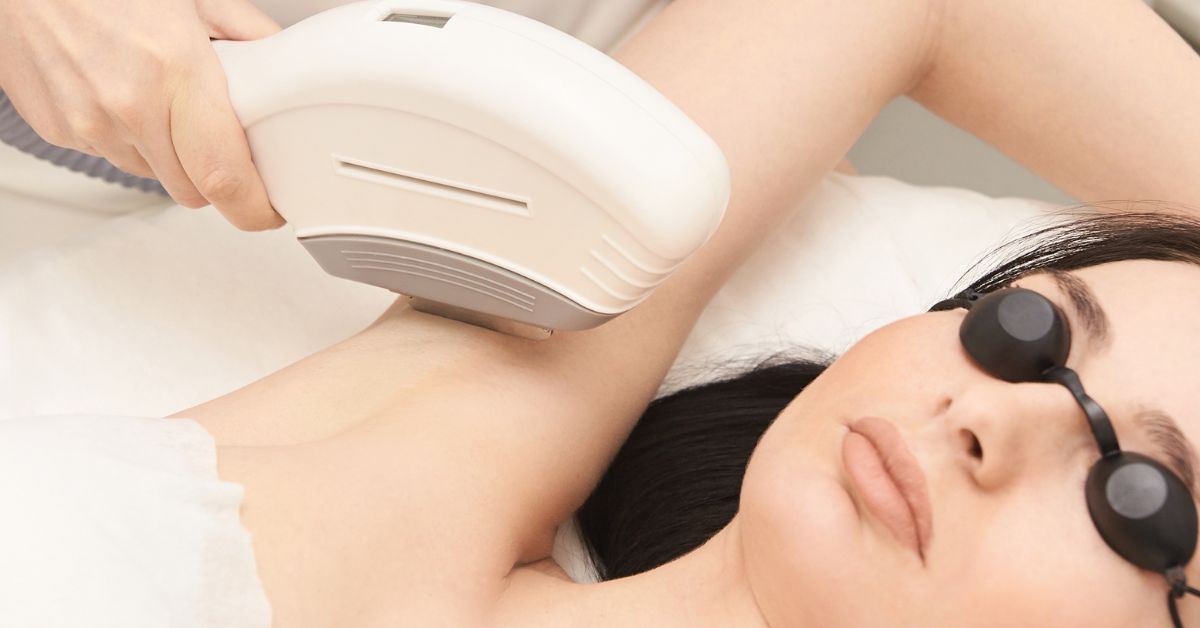 IPL Laser Hair Removal