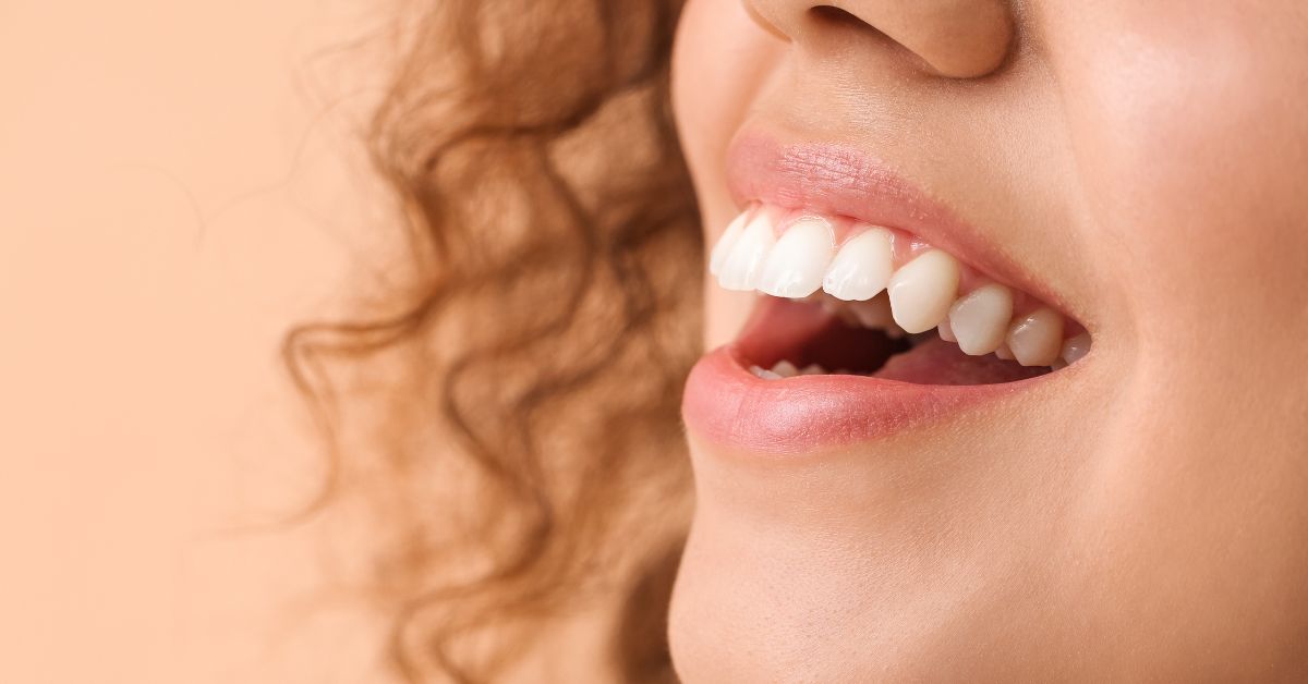 Teeth Whitening Blog Teeth Whitening now at Body Beautiful Day Spa in Aurora, Ontario