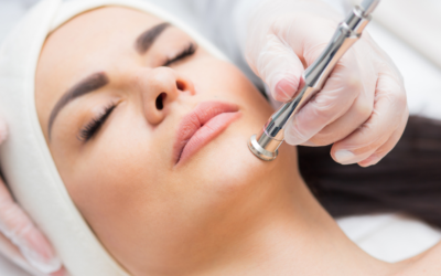 What Is Microdermabrasion? Benefits, Uses & Who It’s For
